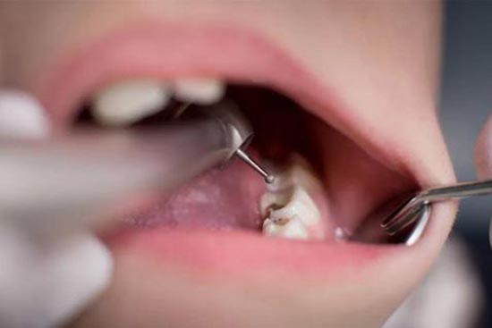 牙龈萎缩的原因是什么？什么原