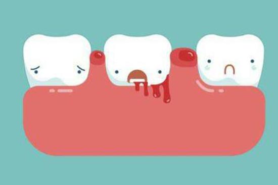 牙龈肿痛的原因有哪些？