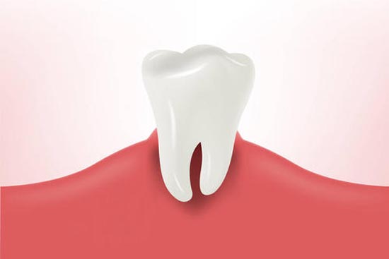 牙龈肿痛怎么办？哪些方法能缓解牙龈肿痛？