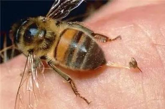 【蜜蜂蜇了怎么办】---蜜蜂蜇